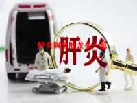 肝炎概念股龙头一览
